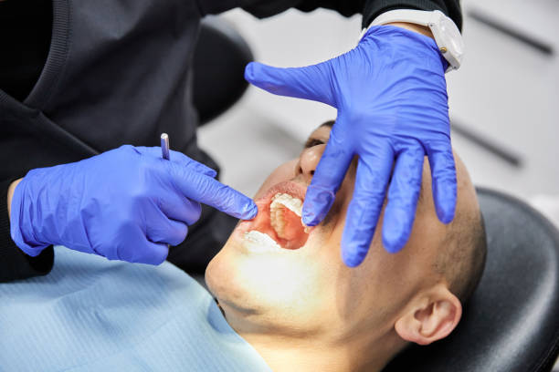 Best Tooth Infection Emergency Dentist  in Marina, CA